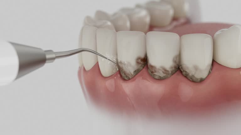 Trusted Wisdom Tooth Removal service in Wilson's Mills, NC - Dentist Open Now